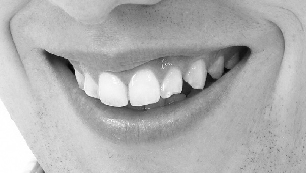 Иллюстрация к книге — Читай лица! Специальная методика чтения лиц и эмоций [i_152.jpg]