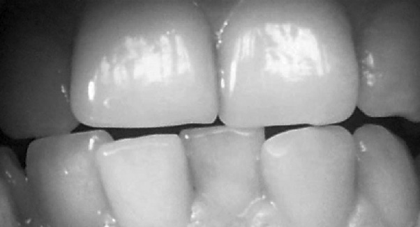 Иллюстрация к книге — Читай лица! Специальная методика чтения лиц и эмоций [i_154.jpg]