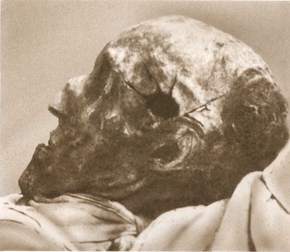 Иллюстрация к книге — Карл XII, или Пять пуль для короля [i_080.jpg]