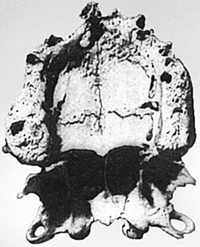 Иллюстрация к книге — Из истории зубоврачевания, или Кто лечит зубы монархам [i_019.jpg]