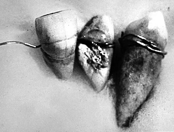 Иллюстрация к книге — Из истории зубоврачевания, или Кто лечит зубы монархам [i_027.jpg]