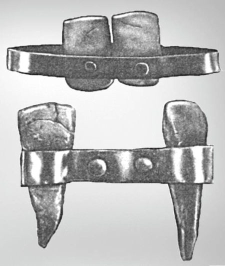 Иллюстрация к книге — Из истории зубоврачевания, или Кто лечит зубы монархам [i_036.jpg]