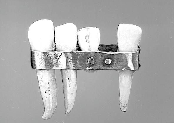 Иллюстрация к книге — Из истории зубоврачевания, или Кто лечит зубы монархам [i_038.jpg]