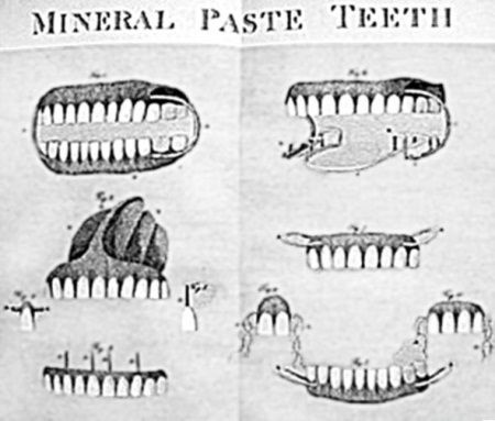 Иллюстрация к книге — Из истории зубоврачевания, или Кто лечит зубы монархам [i_062.jpg]