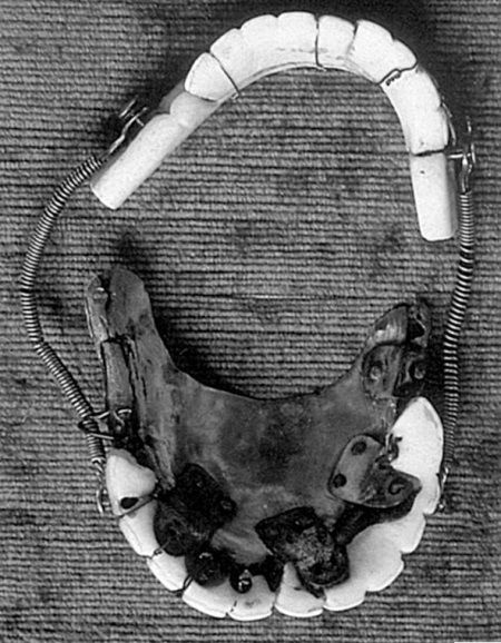 Иллюстрация к книге — Из истории зубоврачевания, или Кто лечит зубы монархам [i_069.jpg]