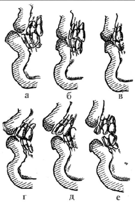 Иллюстрация к книге — Из истории зубоврачевания, или Кто лечит зубы монархам [i_102.jpg]