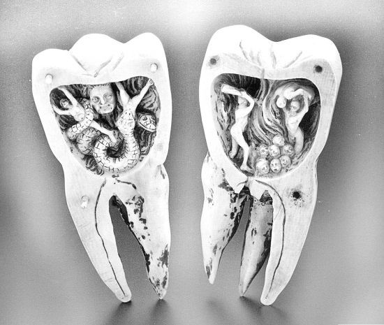 Иллюстрация к книге — Из истории зубоврачевания, или Кто лечит зубы монархам [i_172.jpg]