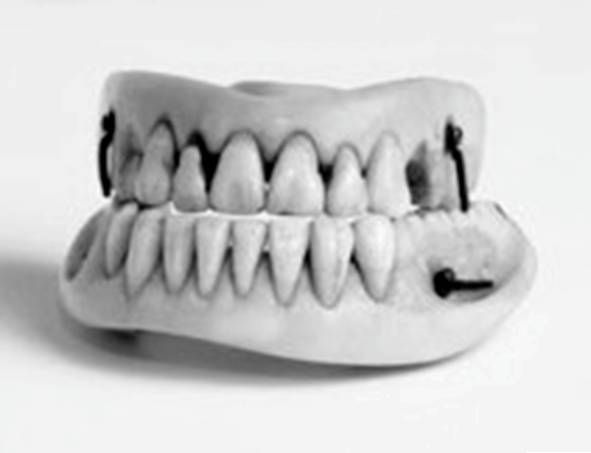 Иллюстрация к книге — Из истории зубоврачевания, или Кто лечит зубы монархам [i_210.jpg]