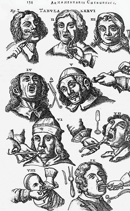 Иллюстрация к книге — Из истории зубоврачевания, или Кто лечит зубы монархам [i_262.jpg]