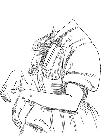 Иллюстрация к книге — Жертвы моды. Опасная одежда прошлого и наших дней [b00000111.jpg]