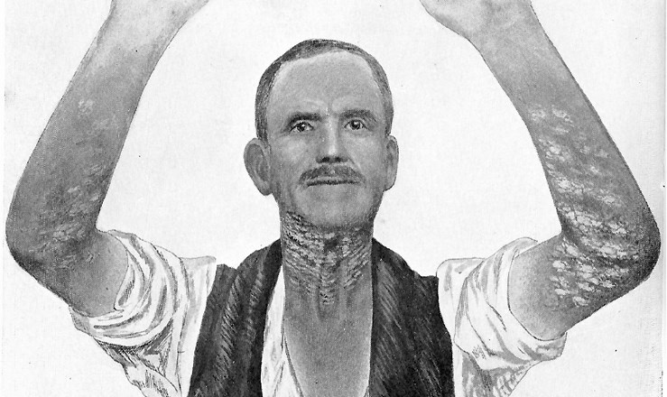 Иллюстрация к книге — Жертвы моды. Опасная одежда прошлого и наших дней [b00000263.jpg]