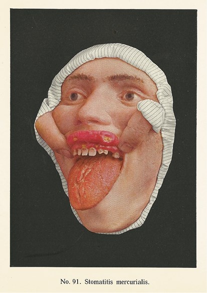 Иллюстрация к книге — Жертвы моды. Опасная одежда прошлого и наших дней [b00000474.jpg]