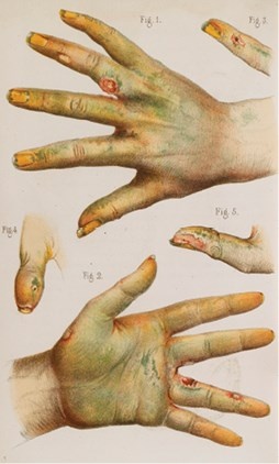 Иллюстрация к книге — Жертвы моды. Опасная одежда прошлого и наших дней [b00000479.jpg]