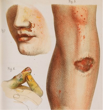 Иллюстрация к книге — Жертвы моды. Опасная одежда прошлого и наших дней [b00000480.jpg]