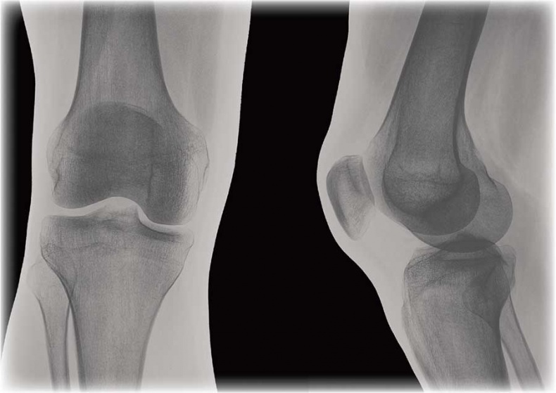 Иллюстрация к книге — Йога-анатомия. Как работают асаны для здоровья и стройности тела [i_010.jpg]