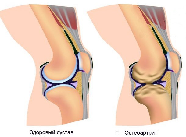Иллюстрация к книге — Теломераза. Как сохранить молодость, укрепить здоровье и увеличить продолжительность жизни [i_016.jpg]