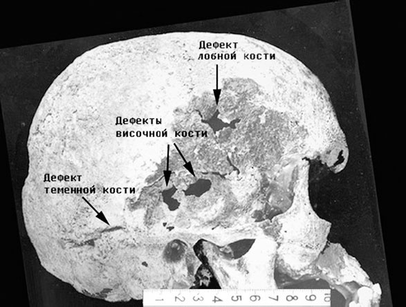 Иллюстрация к книге — Врачи двора его Императорского величества, или Как лечили царскую семью [_64.jpg]