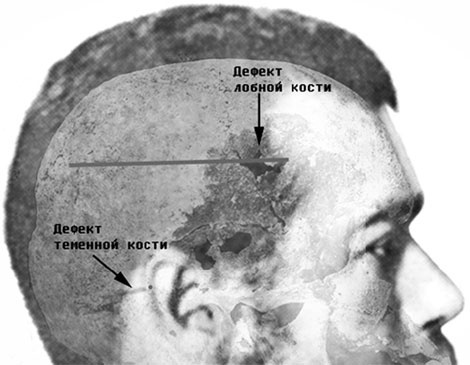 Иллюстрация к книге — Врачи двора его Императорского величества, или Как лечили царскую семью [_66.jpg]