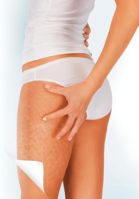 Иллюстрация к книге — Как избавиться от боков, "ушей" и "галифе" [i_004.jpg]