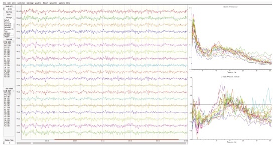 Иллюстрация к книге — Сверхъестественный разум. Как обычные люди делают невозможное с помощью силы подсознания [i_080.jpg]