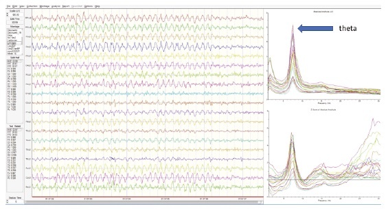 Иллюстрация к книге — Сверхъестественный разум. Как обычные люди делают невозможное с помощью силы подсознания [i_082.jpg]