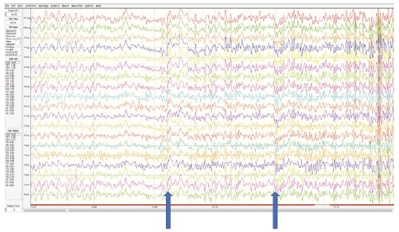 Иллюстрация к книге — Сверхъестественный разум. Как обычные люди делают невозможное с помощью силы подсознания [i_092.jpg]