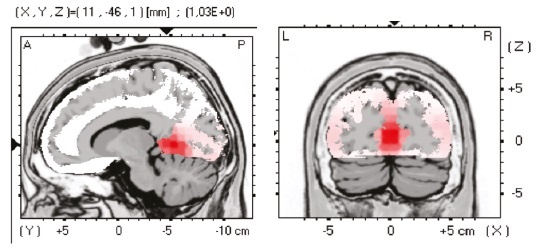 Иллюстрация к книге — Сверхъестественный разум. Как обычные люди делают невозможное с помощью силы подсознания [i_105.jpg]