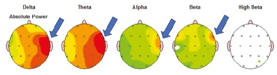 Иллюстрация к книге — Сверхъестественный разум. Как обычные люди делают невозможное с помощью силы подсознания [i_113.jpg]