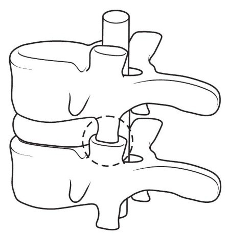 Иллюстрация к книге — Практический курс здоровья для вашего позвоночника [i_004.jpg]