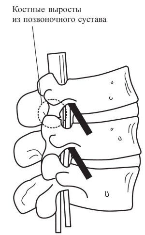 Иллюстрация к книге — Практический курс здоровья для вашего позвоночника [i_058.jpg]