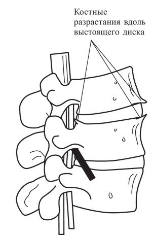 Иллюстрация к книге — Практический курс здоровья для вашего позвоночника [i_059.jpg]