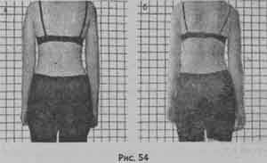 Иллюстрация к книге — Победить боль в спине [i_039.jpg]