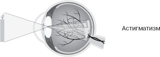 Иллюстрация к книге — Анатомия на пальцах [_138.jpg]