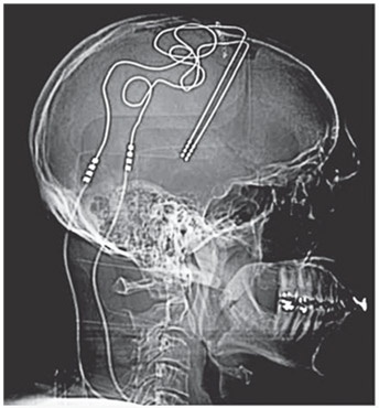 Иллюстрация к книге — Как рождаются эмоции. Революция в понимании мозга и управлении эмоциями [i_020.jpg]