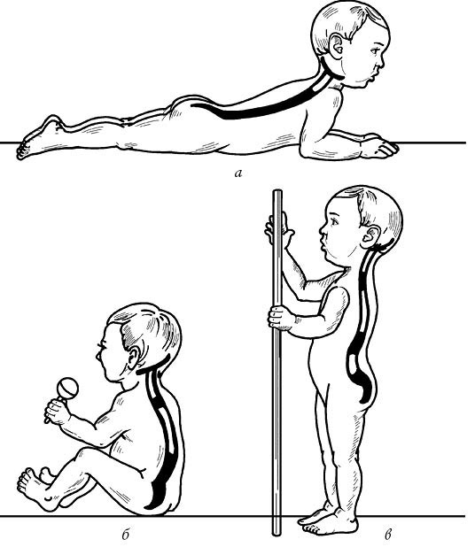 Иллюстрация к книге — Жизнь без боли в спине. Лечение сколиоза, остеопороза, остеохондроза, межпозвонковой грыжи без операции [i_010.jpg]