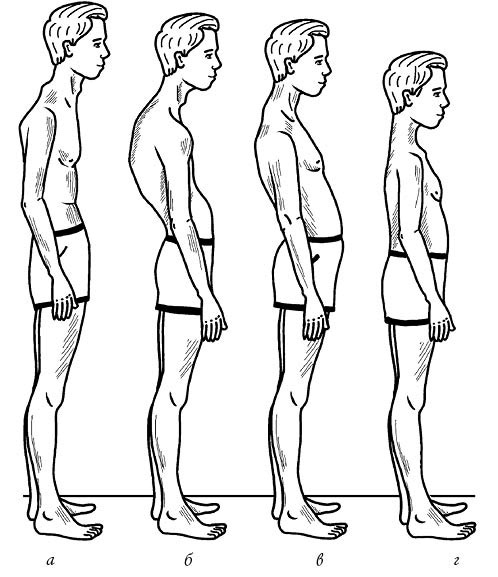 Иллюстрация к книге — Жизнь без боли в спине. Лечение сколиоза, остеопороза, остеохондроза, межпозвонковой грыжи без операции [i_014.jpg]