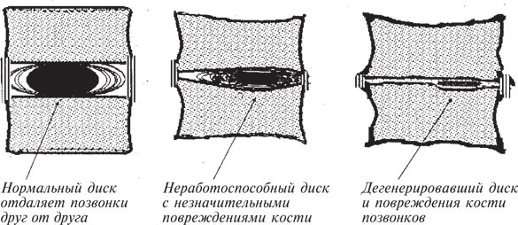 Иллюстрация к книге — Как лечить боли в спине и ревматические боли в суставах [i_008.jpg]