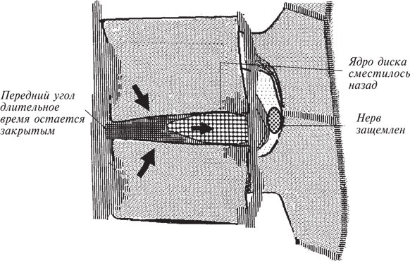 Иллюстрация к книге — Как лечить боли в спине и ревматические боли в суставах [i_052.jpg]