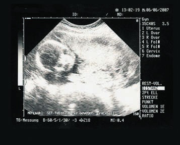 Иллюстрация к книге — От нуля до букваря [i_024.jpg]