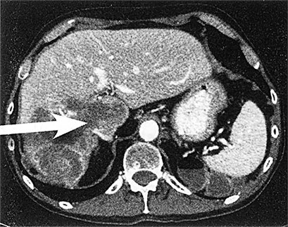 Иллюстрация к книге — Правила здоровой и долгой жизни [i_008.jpg]