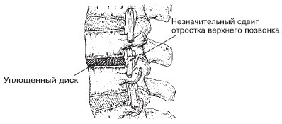 Иллюстрация к книге — Боль в спине. Как определить причину и устранить приступ [i_005.jpg]