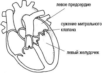 Иллюстрация к книге — Стоп-инфаркт. Как читать ЭКГ и заботиться о сердце [autogen_ebook_id19.jpg]