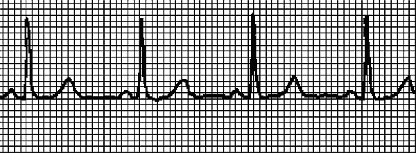 Иллюстрация к книге — Стоп-инфаркт. Как читать ЭКГ и заботиться о сердце [autogen_ebook_id2.jpg]