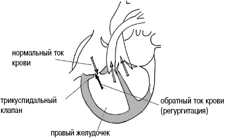 Иллюстрация к книге — Стоп-инфаркт. Как читать ЭКГ и заботиться о сердце [autogen_ebook_id21.jpg]