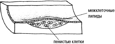 Иллюстрация к книге — Стоп-инфаркт. Как читать ЭКГ и заботиться о сердце [autogen_ebook_id24.jpg]
