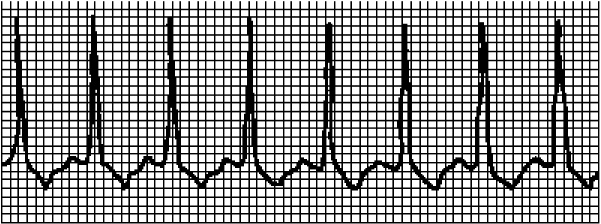 Иллюстрация к книге — Стоп-инфаркт. Как читать ЭКГ и заботиться о сердце [autogen_ebook_id8.jpg]