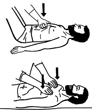 Иллюстрация к книге — Бронхи и легкие. Советы и рекомендации ведущих врачей [_192.jpg]