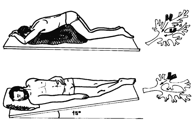 Иллюстрация к книге — Бронхи и легкие. Советы и рекомендации ведущих врачей [_195.jpg]