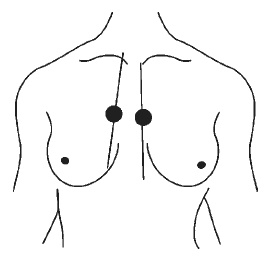 Иллюстрация к книге — Лечебный самомассаж. Основные техники [i_032.jpg]