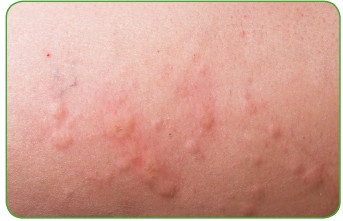 Иллюстрация к книге — Энциклопедия диагностики и лечения от А до Я [i_009.jpg]